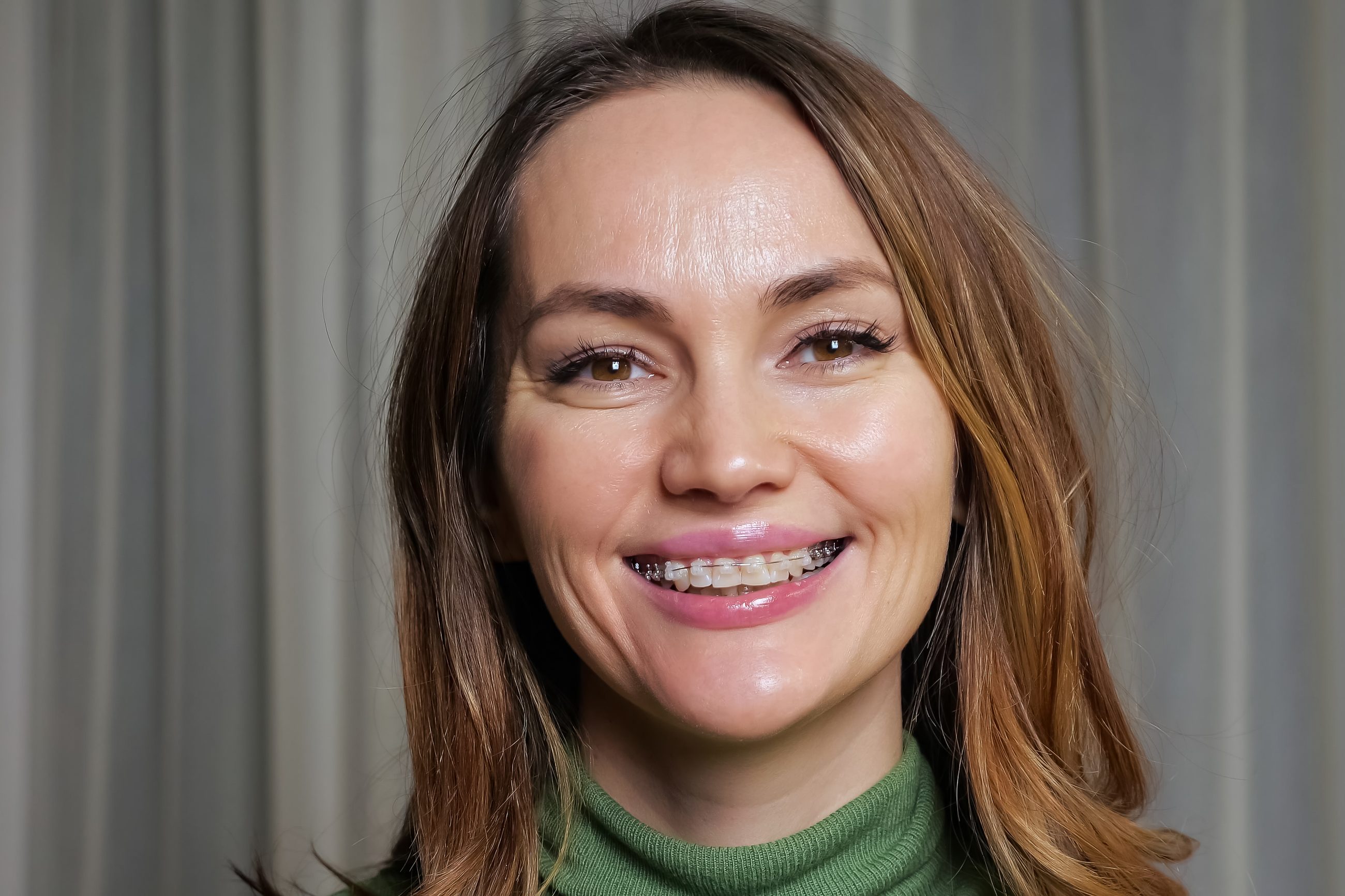 An adult woman smiling with braces